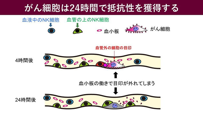 ナチュラルキラー（NK）細胞による転移がん細胞殺傷の可視化 －NK細胞とがん細胞の肺毛細血管上での戦いを実況中継する－